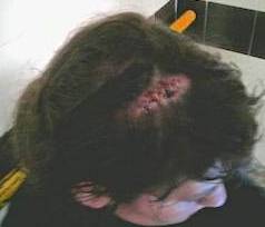 Noia agredida la setmana passada amb cop de porra per la policia a València, amb diversos punts al cap.