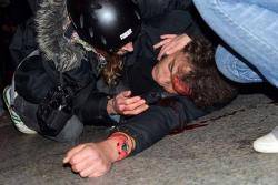 Manifestant estès a terra i assistit després de rebre un impacte de pilota de goma