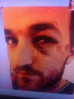 Dimecres passat Rafael Martín,  un aficionat del F.C. Barcelona que havia anat a la final de la Copa del Rei a València, va ser agredit per 8 agents de la policia nacional espanyola al crit de Te vas a enterar catalán de mierda