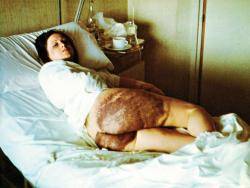 Amparo Arangoa, víctima de tortures el 1976. Foto: El Temps