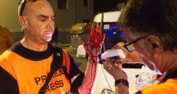 El fotoperiodista David Aparicio, que treballava pel 'Diari de Girona' i anava acreditat amb armilla, va ser ferit al colze per una bala de foam. Foto: Mèdia.cat
