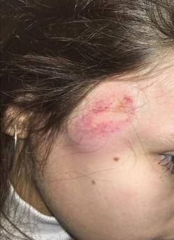 Imatge del cap d'una noia de 15 anys agredida pels Mossos d'Esquadra a prop del Camp Nou (18/12/2019)