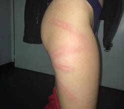 Imatge de les cames d'una noia de 15 anys agredida pels Mossos d'Esquadra a prop del Camp Nou (18/12/2019)