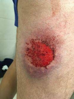 Ferit per impacte de pilota de foam disparada pels Mossos d'Esquadra a prop del Camp Nou (18/12/2019)