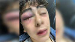 La policia turca tortura un nen kurd de 14 anys