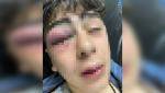 La policia turca tortura un nen kurd de 14 anys